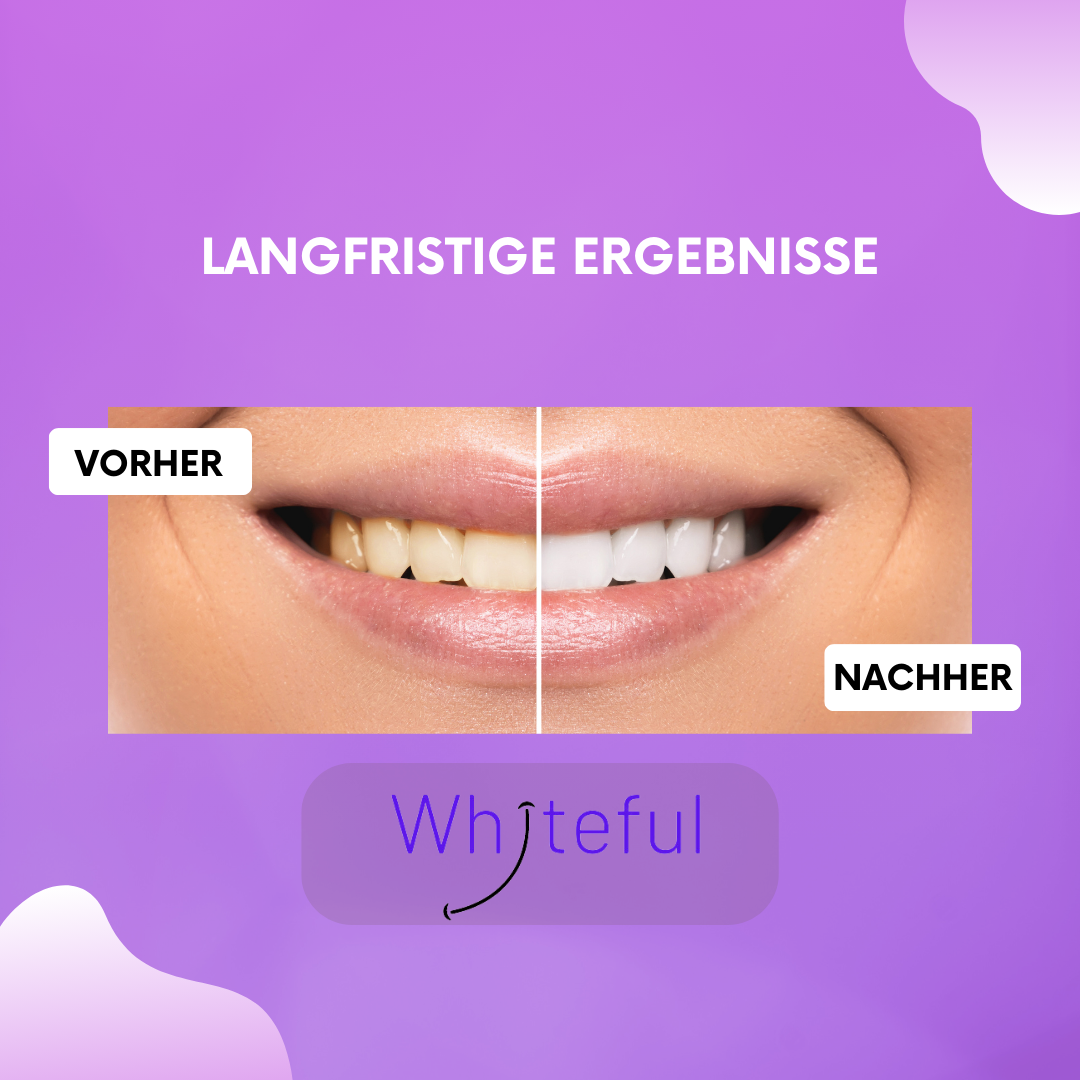 Whiteful - Farbkorrektur Serum