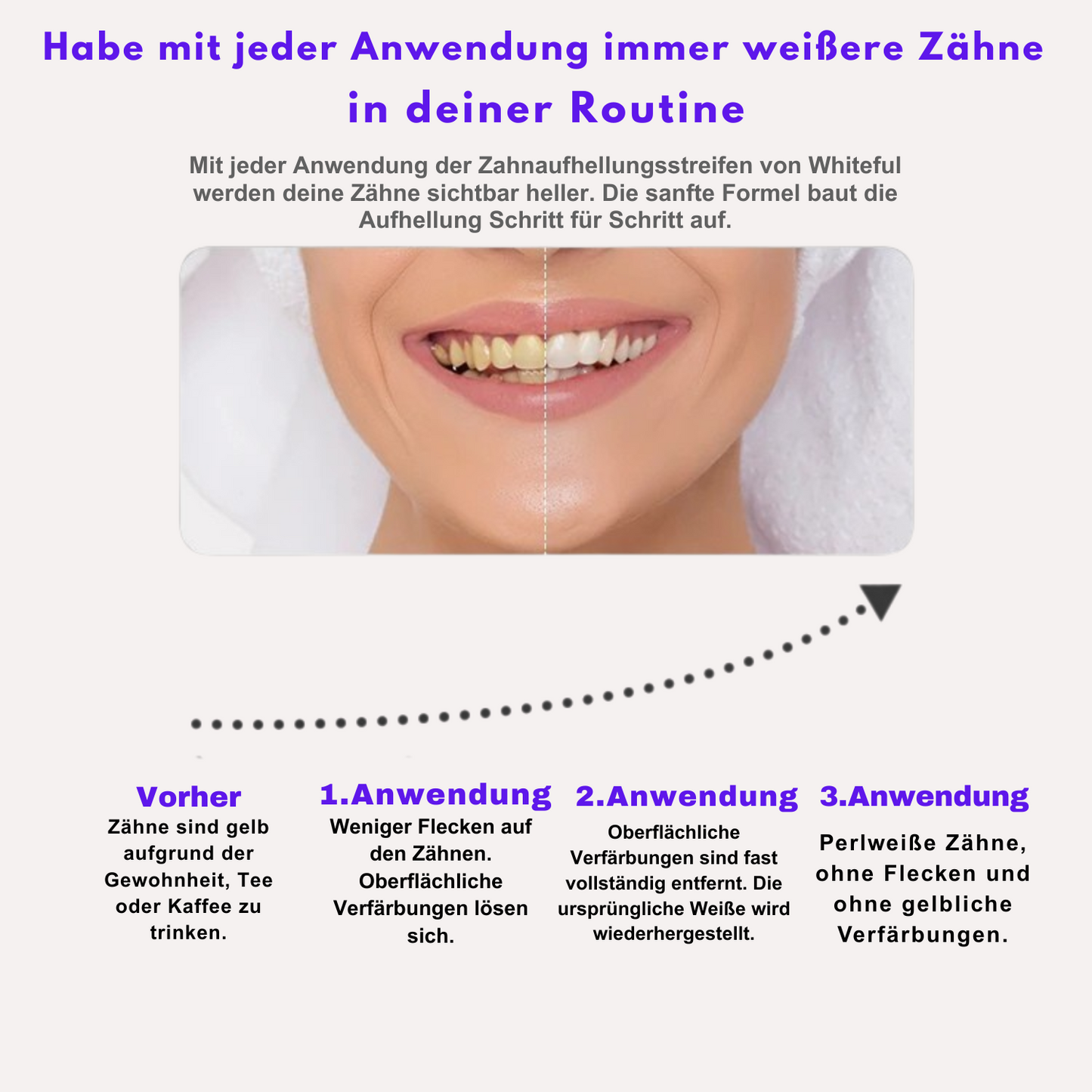 Whiteful - Zahnaufhellungsstreifen-Set