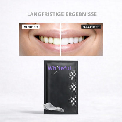 Whiteful - Zahnaufhellungsstreifen-Set